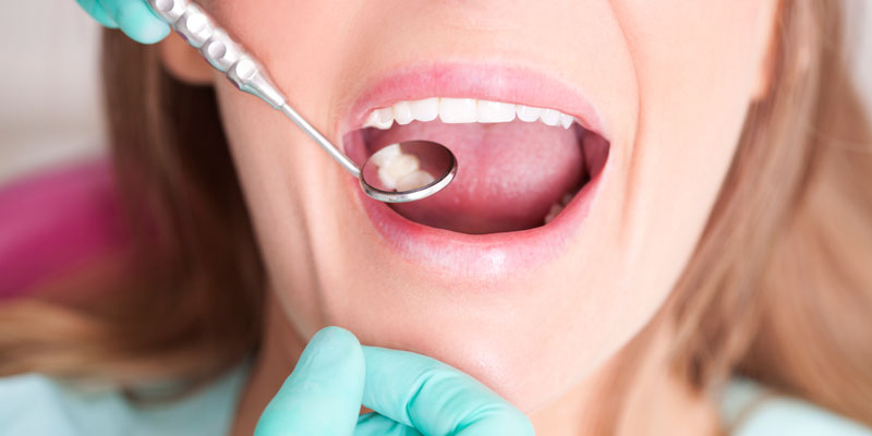 Dental Check for Cavities